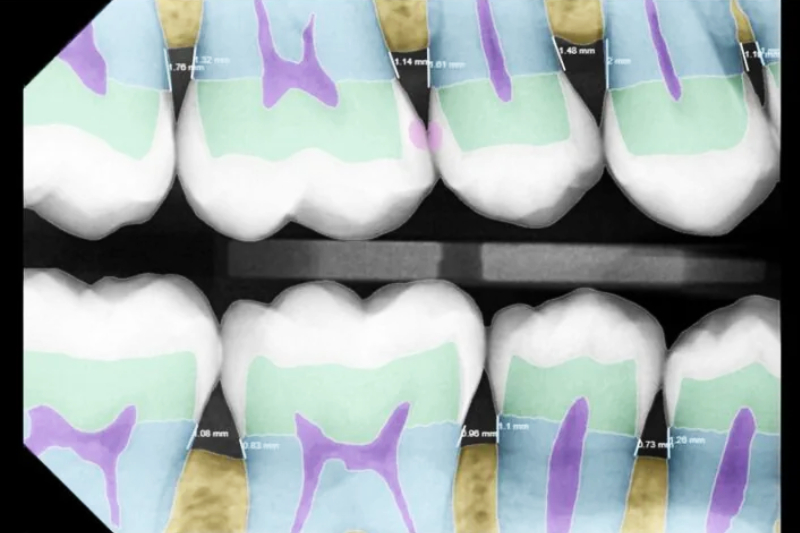 Pearl AI in Asheville