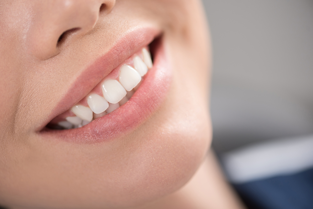 Fix Chipped Tooth With Cosmetic Dentistry in Asheville, NC