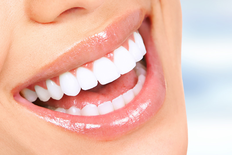 Dental Veneers Dentist in Asheville at Embark Dental